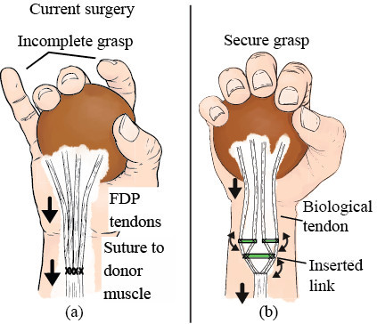 Meka Robotics Hand Implantable adaptive grasping mechanism