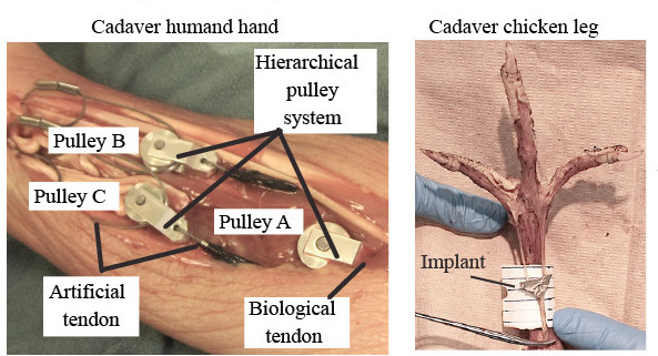 Meka Robotics Hand Implantable adaptive grasping mechanism